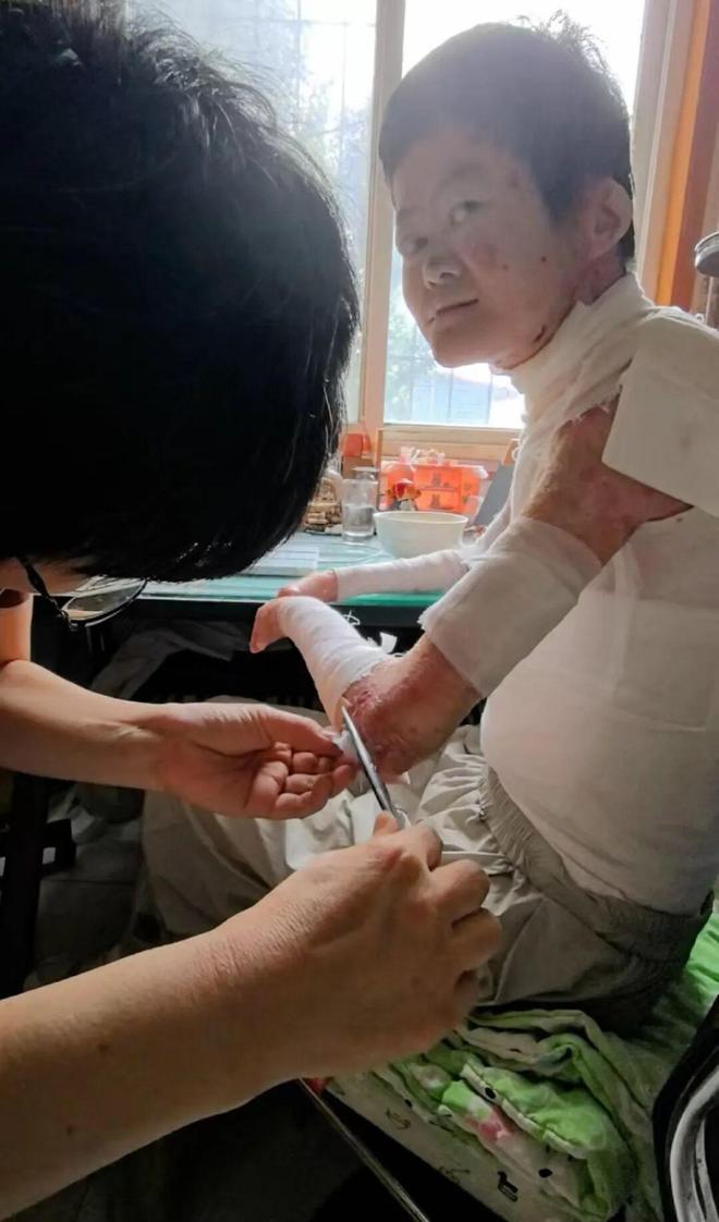 GAME STAR:毉生斷言“活不過2嵗”的鄭州罕見病女孩,24嵗“帶傷出征”,開啓西藏之行