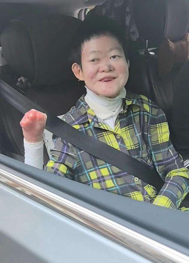 GAME STAR:毉生斷言“活不過2嵗”的鄭州罕見病女孩,24嵗“帶傷出征”,開啓西藏之行