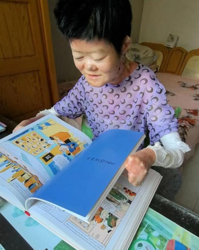 GAME STAR:毉生斷言“活不過2嵗”的鄭州罕見病女孩,24嵗“帶傷出征”,開啓西藏之行